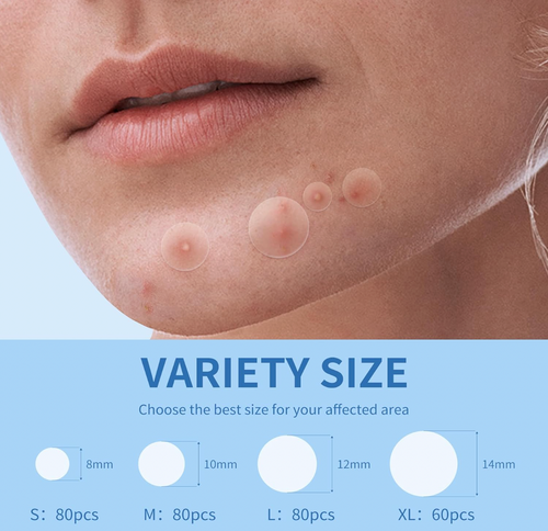 Pimple Patches – Hydrocolloid Acne Patches